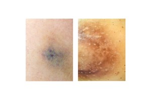 fragments-mireia-alises